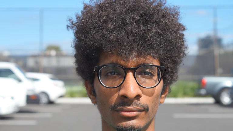 탈모 실비 청구 후기와 지급 거절 대처법 1