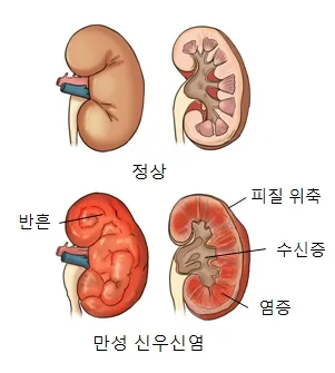 옆구리에 따뜻한 찜질을 하는 장면