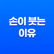 자고 일어나면 손이 붓는 이유와 대처방법 29