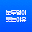 눈두덩이 붓는 이유와 눈두덩이 부기를 줄이는 방법 19