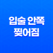 입술 안쪽 찢어짐(+ 원인부터 치료법까지 알아보기) 23