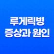 루게릭병 증상과 원인(+ 치료법과 예방 방법까지) 51