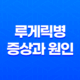 루게릭병 증상과 원인(+ 치료법과 예방 방법까지) 31